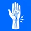 Carpal Tunnel Syndrome